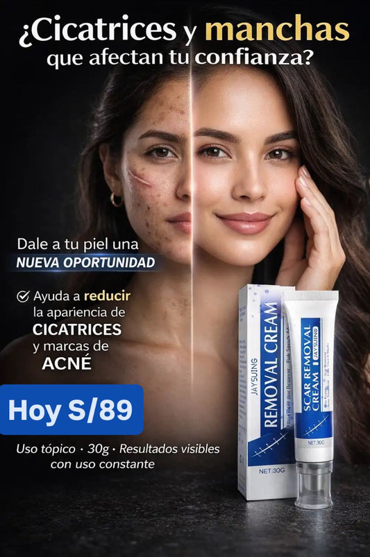 Nueva Crema Scar Removal®: Borra tus cicatrices y recupera la suavidad de tu piel en solo 14 días