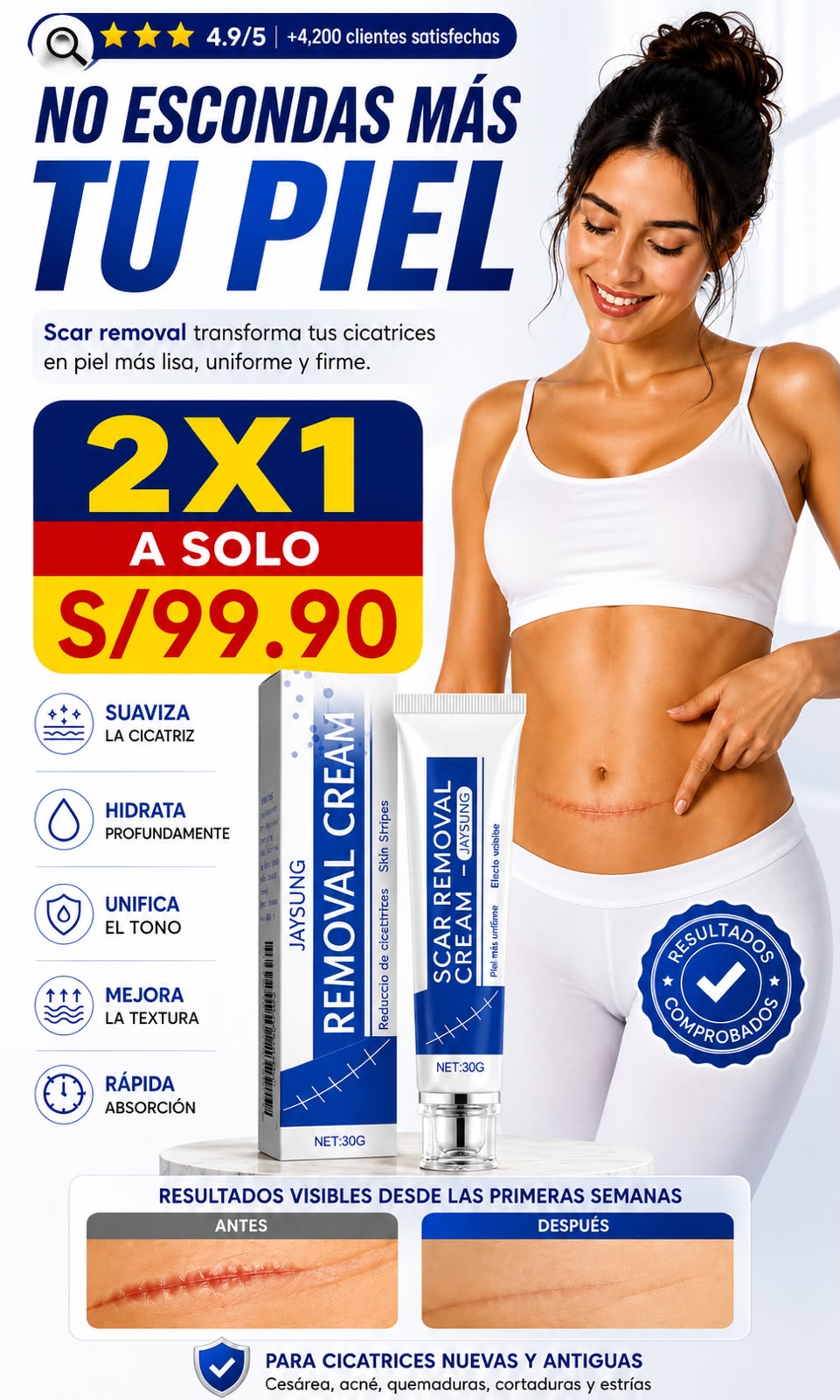 Nueva Crema Scar Removal®: Borra tus cicatrices y recupera la suavidad de tu piel en solo 14 días